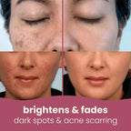 Shapenix Kojic Acid And Turmeric 40 Pieces Cleansing Pads Skin Brightening, Fades Dark Spots, Tan Remove, Anti-aging